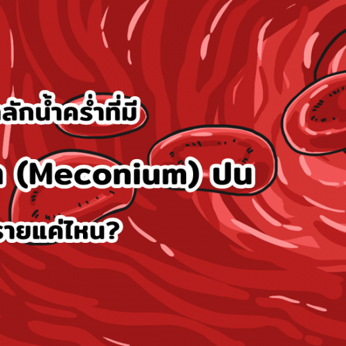 ลูกสำลักน้ำคร่ำที่มีขี้เทา (Meconium) ปน อันตรายแค่ไหน?