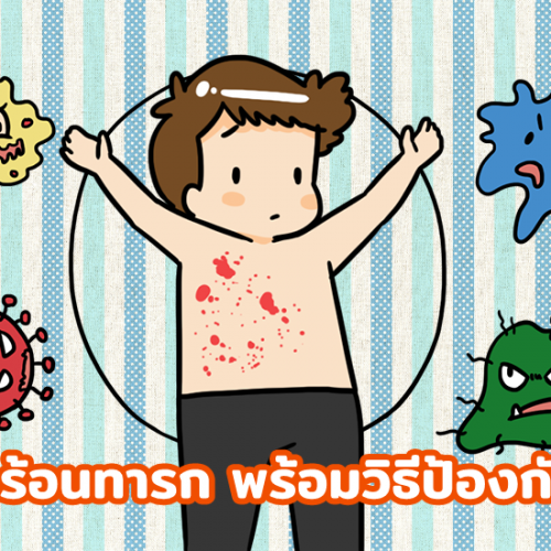 ผดร้อนทารก พร้อมวิธีป้องกัน