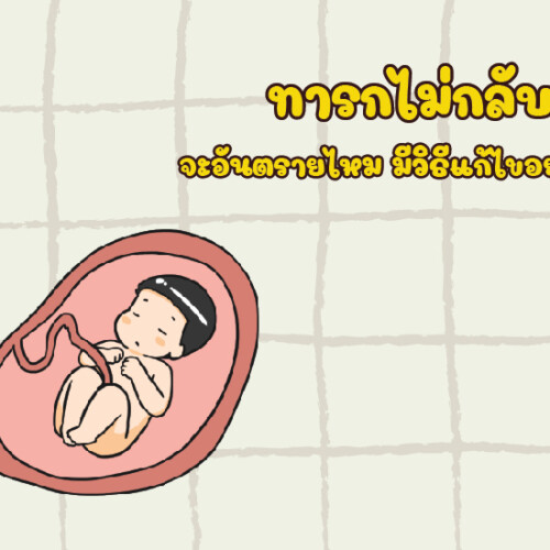 ทารกไม่กลับหัว จะอันตรายไหม มีวิธีแก้ไขอย่างไร